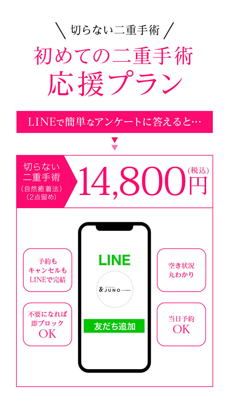  切らない二重手術 初めての二重手術応援プラン