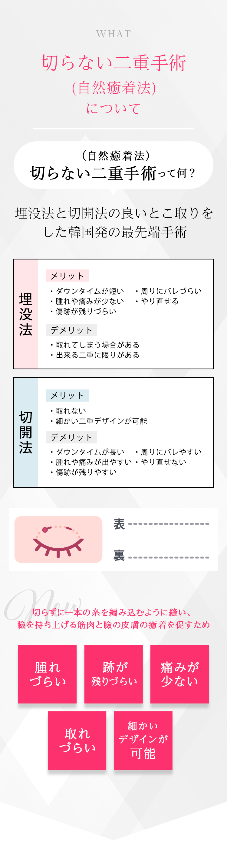 切らない二重手術（自然癒着法）について